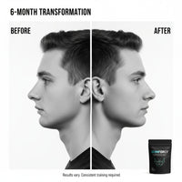 GUMFORCE™ Ultra-Hard Jawline Trainer